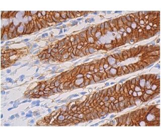 beta-catenin Antibody (6F9) - Immunohistochemistry - Image 357850 