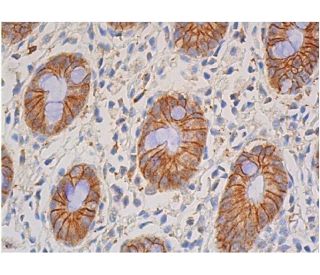 beta-catenin Antibody (A-12) - Immunohistochemistry - Image 357855 