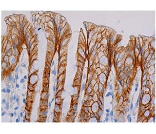 beta-catenin Antibody (A-5) - Immunohistochemistry - Image 333981 