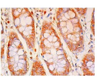 beta-catenin Antibody (B-9) - Immunohistochemistry - Image 315734 