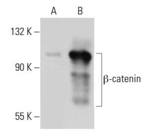 beta-catenin Antibody (BDI870) - Western Blotting - Image 34786 