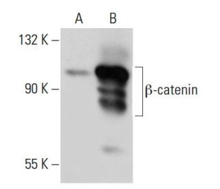 beta-catenin Antibody (BDI920) - Western Blotting - Image 34788 