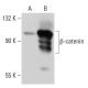 beta-catenin Antibody (BDI920) - Western Blotting - Image 34788 