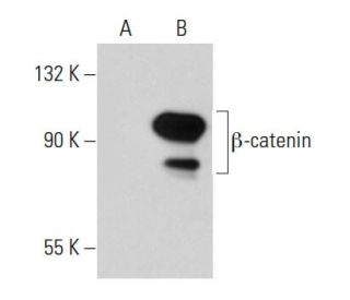 beta-catenin Antibody (C-1F12) - Western Blotting - Image 34760 