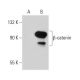 beta-catenin Antibody (C-1F12) - Western Blotting - Image 34760 