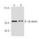 beta-catenin Antibody (C-1F12) - Western Blotting - Image 62822