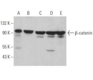 beta-catenin Antibody (D-10) - Western Blotting - Image 362164 