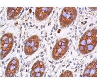beta-catenin Antibody (E-2) - Immunohistochemistry - Image 357854 