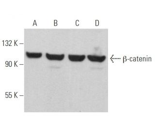 beta-catenin Antibody (H-1) - Western Blotting - Image 362160 