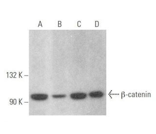beta-catenin Antibody (H-2) - Western Blotting - Image 350018 