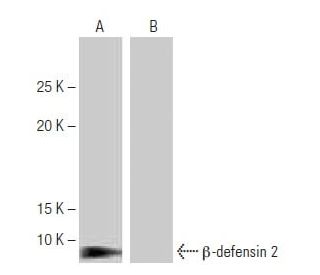 &beta;-defensin 2 Antibody (2-RY8) - Western Blotting - Image 64908