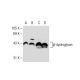 β-dystroglycan Antibody (56) - Western Blotting - Image 109667 