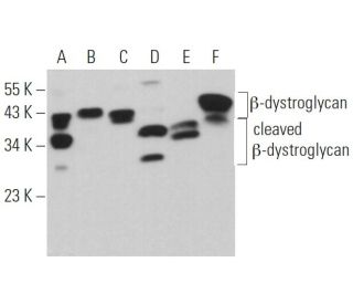 &beta;-dystroglycan Antibody (B-6) - Western Blotting - Image 361661 