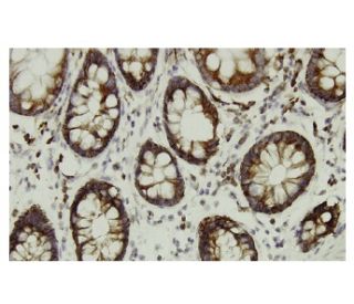 &beta; Enolase Antibody (XX-10) - Immunohistochemistry - Image 36171 