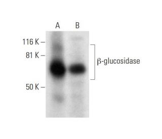 &beta;-glucosidase Antibody (B-6) - Western Blotting - Image 295830 