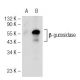beta-glucosidase (B-6): sc-166407. Western blot analysis of beta-glucosidase expression in...