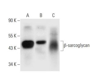&beta;-sarcoglycan Antibody (F-6) - Western Blotting - Image 297032 