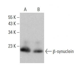 beta Synuclein Antibody (8) - Western Blotting - Image 377635