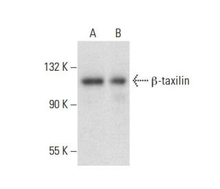 &beta;-taxilin Antibody (E-5) - Western Blotting - Image 300568