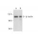 β-taxilin Antibody (E-5) - Western Blotting - Image 300568