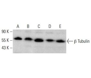 beta Tubulin Antibody (JDR.3B8) - Western Blotting - Image 377435 