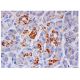 beta 2 Adrenergic Receptor/ADRB2/β2-AR Antibody (R11E1) - Immunohistochemistry - Image 284807 