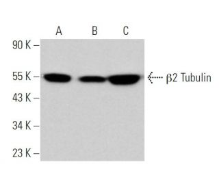 &beta;2 Tubulin Antibody (7B9) - Western Blotting - Image 374640 