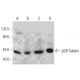 β2B Tubulin Antibody (AT5B3) - Western Blotting - Image 385113