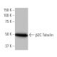 β2C Tubulin Antibody (1A9) - Western Blotting - Image 64798 