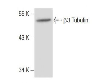 &beta;3 Tubulin Antibody (3H3091) - Western Blotting - Image 38048