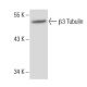β3 Tubulin Antibody (3H3091) - Western Blotting - Image 38048