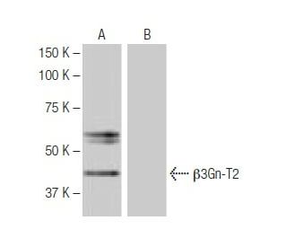 &beta;3Gn-T2 Antibody (8G8) - Western Blotting - Image 64799