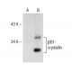 βB1-crystallin Antibody (A-8) - Western Blotting - Image 151180