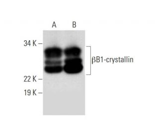 &beta;B1-crystallin Antibody (A-8) - Western Blotting - Image 294259 