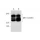 βB1-crystallin Antibody (A-8) - Western Blotting - Image 294259 