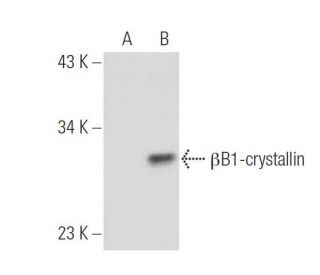 &beta;B1-crystallin Antibody (H-3) - Western Blotting - Image 49903 
