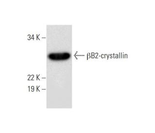 &beta;B2-crystallin Antibody (B-12) - Western Blotting - Image 294257 