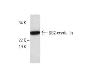 &beta;B2-crystallin Antibody (D-1) - Western Blotting - Image 293097 