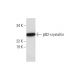 βB2-crystallin Antibody (D-1) - Western Blotting - Image 293097 