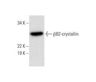 &beta;B2-crystallin Antibody (H-1) - Western Blotting - Image 294258 