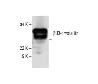 &beta;B3-crystallin Antibody (G-3) - Western Blotting - Image 294260 
