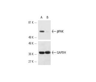 &beta;PAK siRNA (h): sc-36181. Western blot analysis of &beta;PAK expression in non-transfected control (A) and &beta;PAK