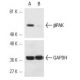 βPAK siRNA (h): sc-36181. Western blot analysis of βPAK expression in non-transfected control (A) and βPAK