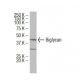Biglycan Antibody (3E2) - Western Blotting - Image 34229