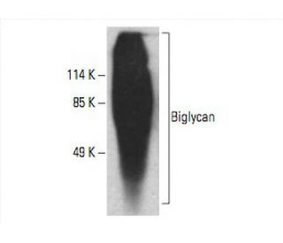 Biglycan Antibody (910E2) - Western Blotting - Image 393588 