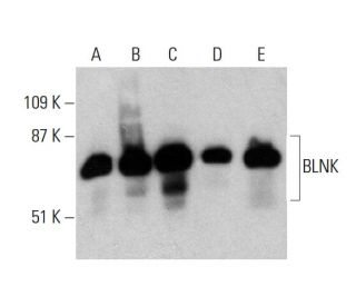 BLNK Antibody (2B11) - Western Blotting - Image 385746 