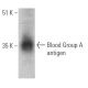 Blood Group A antigen Antibody (HE-10) - Western Blotting - Image 368563