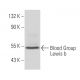 Blood Group Lewis b Antibody (T218) - Western Blotting - Image 16368