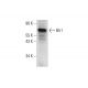 Blr1 Antibody (C-3) - Western Blotting - Image 299276 