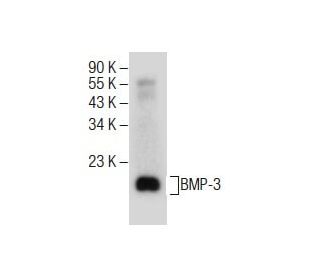 BMP-3 Antibody (C-9) - Western Blotting - Image 285403The Double Nickase Plasmid features a U6 promoter for sgRNA expression, a 20 nt targeting sequence, and a gRNA scaffold to guide Cas9n. It includes a CBh promoter for Cas9n (D10A) and puromycin resistance, GFP for transfection verification, and nuclear localization signals (NLS). The 2A peptide allows co-expression of Cas9n and Puro from a single promoter, enabling precise genome editing with reduced off-target effects.